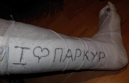 Разрисованный гипс на ноге