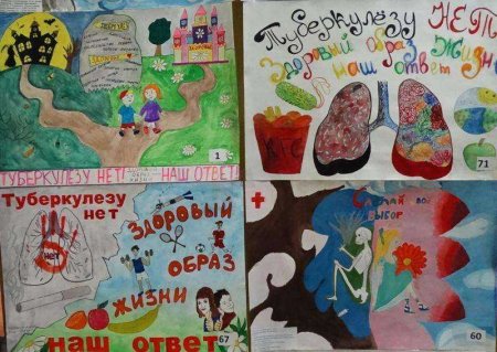 Нет туберкулезу