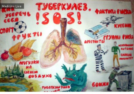 Туберкулез рисунок