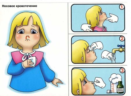 Оказание первой медицинской помощи для детей