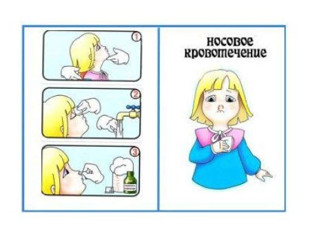 Оказание первой помощи детям
