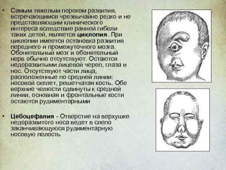 Носовое дыхание на белом фоне