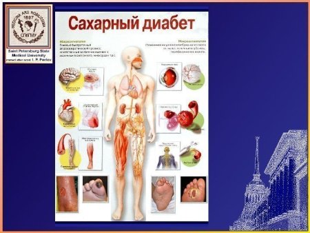 Сахарный диабет рисунок