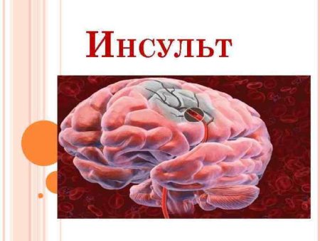 Презентация по теме инсульт
