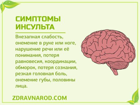 Признаки инсульта
