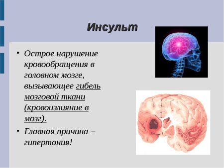 Инсульт это острое нарушение кровообращения в