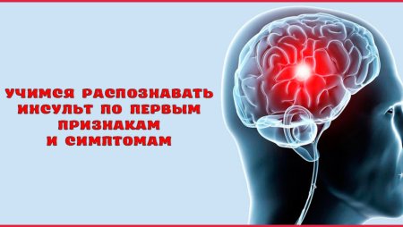 Инсульт мозга симптомы первые признаки