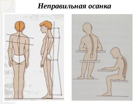 Правильная осанка дошкольника