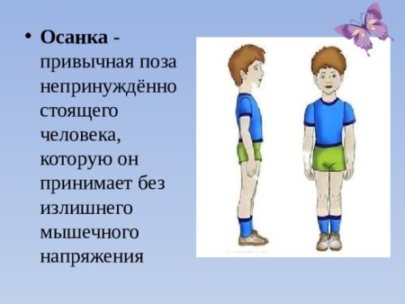 Правильная осанка