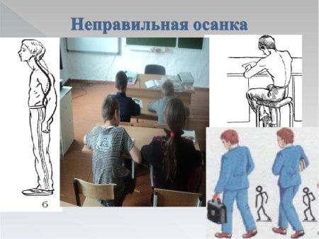 Правильная осанка рисунок