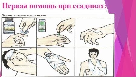 Первая помощь при ссадинах