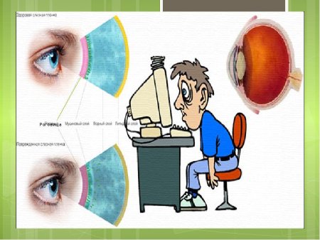Профилактика зрения у детей