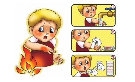 Оказание первой помощи при ожогах для детей