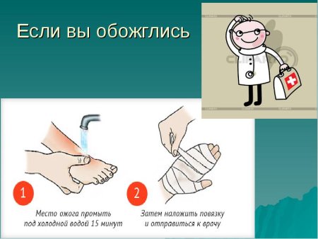 Оказание первой помощи при ожогах для детей