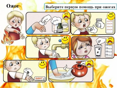 Оказание первой медпомощи при ожогах
