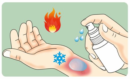 Химические и термические ожоги презентация