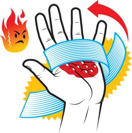 Термический ожог рисунок