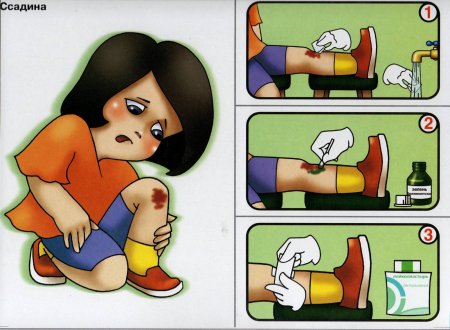 Оказание первой помощи детям