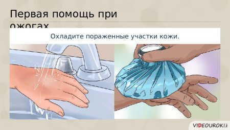 Ожоги первая помощь при ожогах