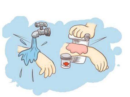 Химический ожог иллюстрации