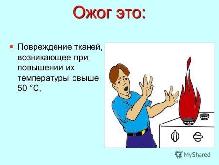 Ожог презентация по ОБЖ