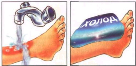 Оказание первой помощи при ожогах рисунок