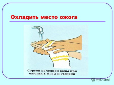 Что нельзя делать при ожогах