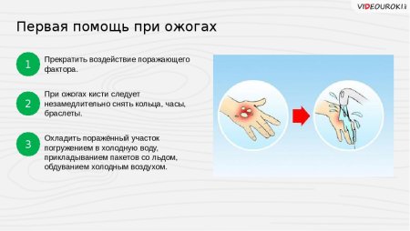 Алгоритм оказания первой помощи при ожогах, отморожениях