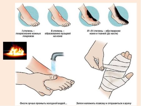 Оказание первой помощи при ушибах для детей