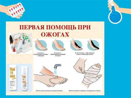 Термические и химические ожоги