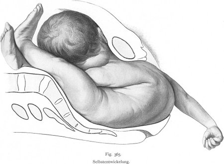 Анатомические рисунки младенцев