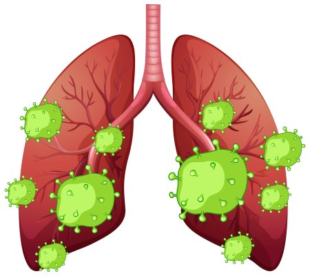 Здоровые и больные легкие
