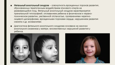 Алкогольный синдром причины