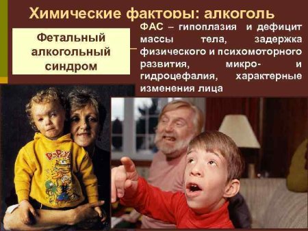 День распространения информации о фетальном алкогольном синдроме