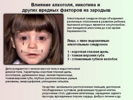 Дети алкоголиков алкогольно-фетальный синдром