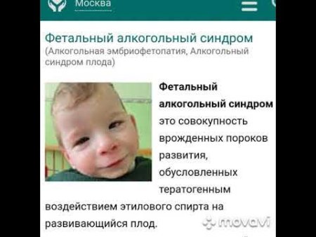 Алкогольный синдром плода клинические рекомендации