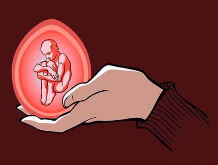 Прерывание беременности рисунок