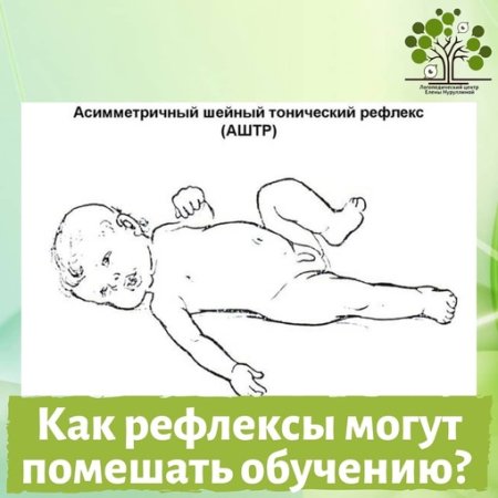 Лабиринтный тонический рефлекс новорожденного