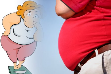 Ожирение у детей картинки