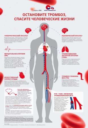 Всемирный день борьбы с тромбозом