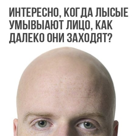 День лысины