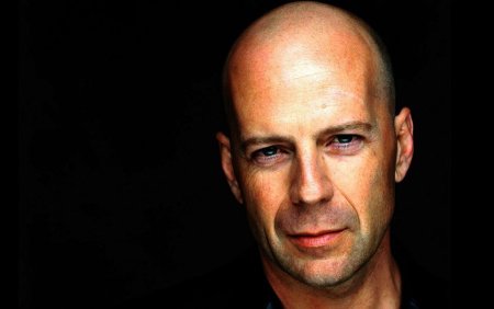 Международный день лысых