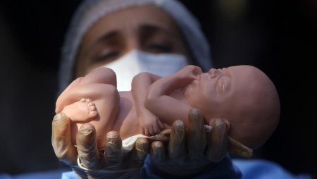 Плод ребенка