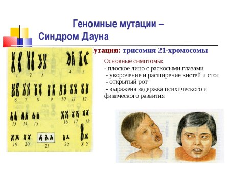 Синдром Дауна геномная мутация
