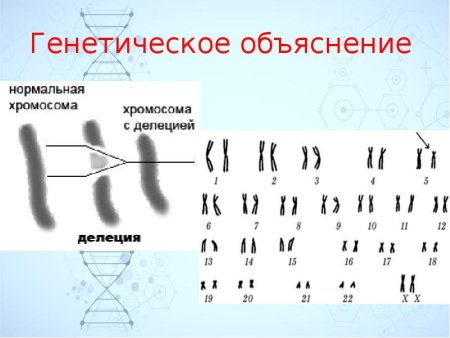 Кариограмма синдрома кошачьего крика