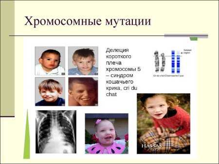Делеции хромосомных мутаций