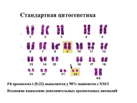 Стандартная цитогенетика
