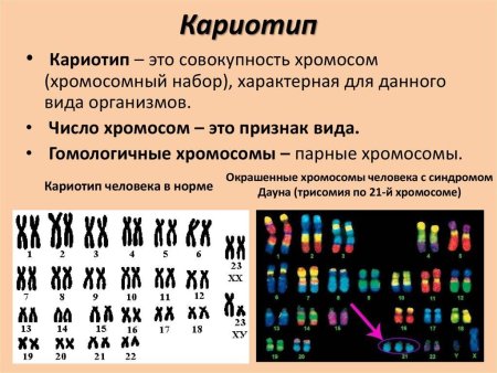 Кариотип 46хх расшифровка