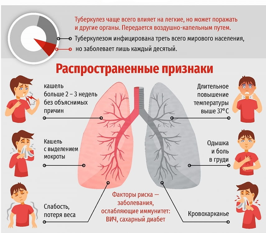 Пневмония легких опасно. Основные признаки туберкулеза. Проявление туберкулеза. Основные проявления туберкулеза.