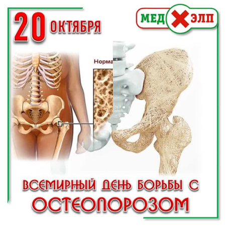 Всемирный день остеопороза